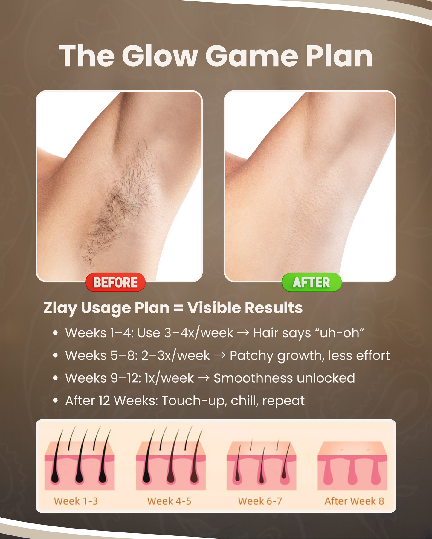 Painless, At-Home Hair Removal—Zlay IPL Hair Remover Device