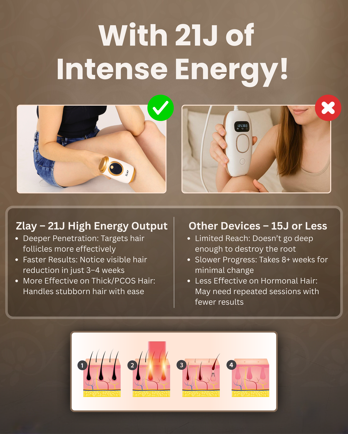Painless, At-Home Hair Removal—Zlay IPL Hair Remover Device